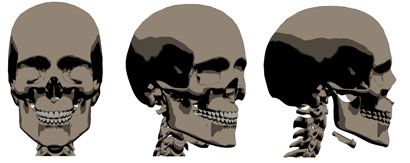 Allen Skull set